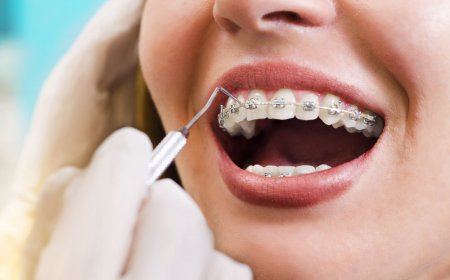 What is orthodontics? Modern treatments for dental alignment