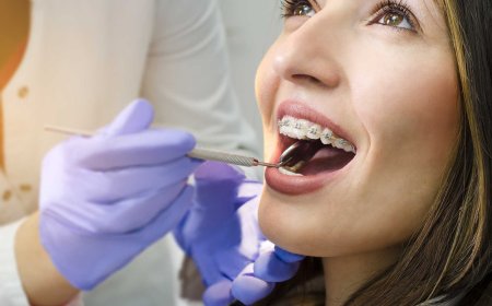 Orthodontic treatment guide: Process, benefits, and oral care