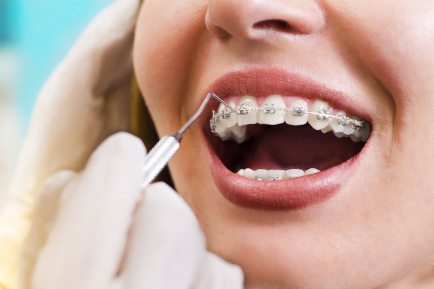 What is orthodontics? Modern treatments for dental alignment