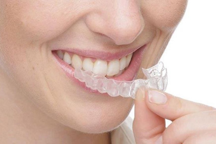Can I have an MRI with dental implants? Safety and compatibility