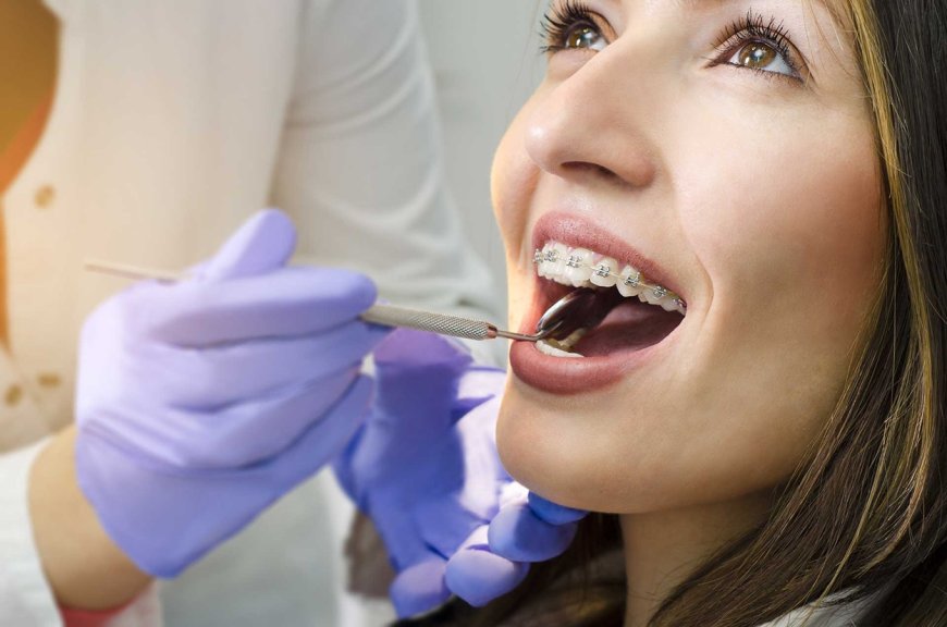 Orthodontic treatment guide: Process, benefits, and oral care