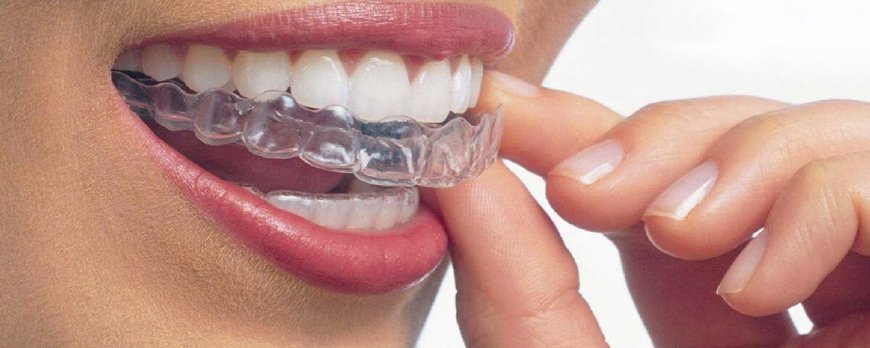What is removable orthodontic treatment? Benefits and ideal age